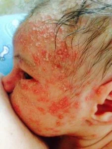 a close up of a babys face description automatic 1 226x300 1